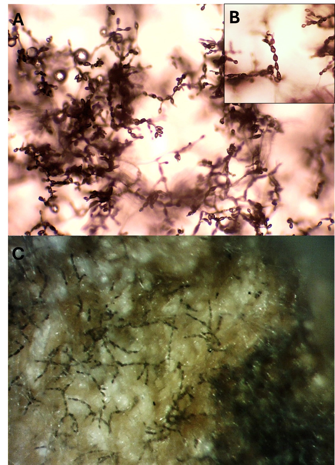 A magnification of the pathogen that causes Alternaria leaf spot, in color.